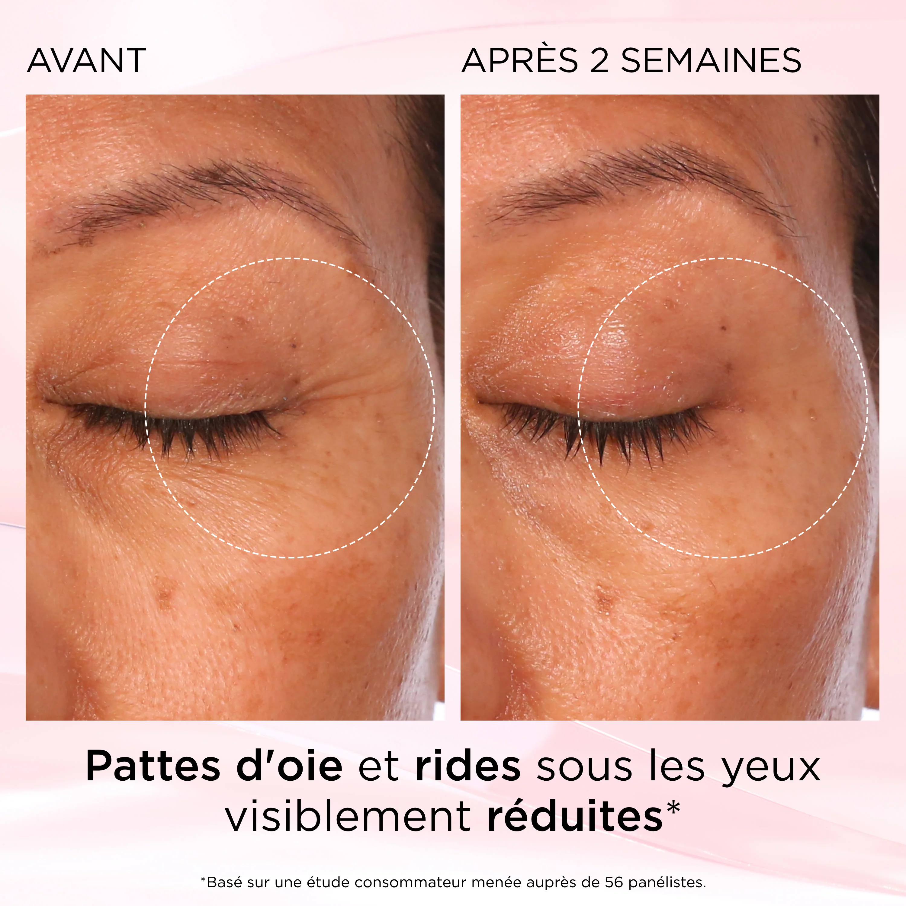 Rétinol + HPR Ceramide Crème Contour des Yeux Régénérante - Image 11